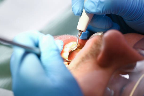 Best Emergency Treatment for Oral Infections in Oak Hill, FL