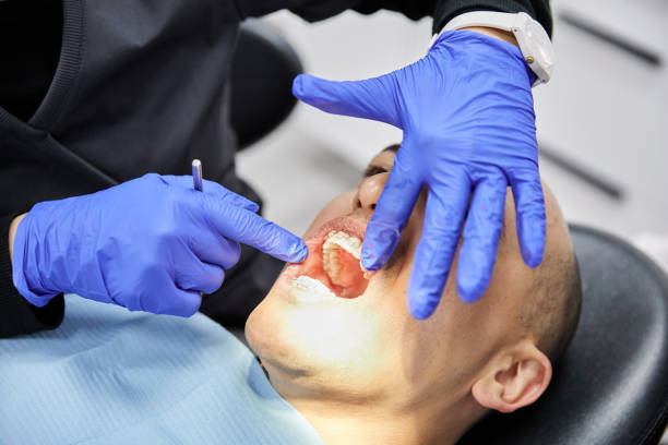 Best Emergency Wisdom Tooth Extraction in Oak Hill, FL